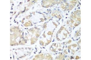 Immunohistochemistry of paraffin-embedded Human stomach using RPH3AL Polyclonal Antibody at dilution of 1:100 (40x lens). (RPH3AL antibody)