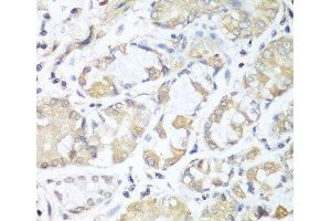 Immunohistochemistry of paraffin-embedded Human stomach using RPH3AL Polyclonal Antibody at dilution of 1:100 (40x lens).