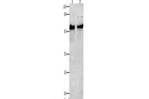 Western Blot analysis of Human liver cancer tissue and Hela cells using SMAD4 Polyclonal Antibody at dilution of 1:150 (SMAD4 antibody)