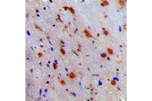 Immunohistochemical analysis of NEURL1 staining in human brain formalin fixed paraffin embedded tissue section. (NEURL antibody  (Center))
