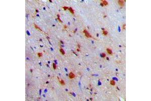 Immunohistochemical analysis of NEURL1 staining in human brain formalin fixed paraffin embedded tissue section.