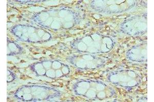 Immunohistochemistry of paraffin-embedded human epityphlon tissue using ABIN7171057 at dilution of 1:100 (SMARCC2 antibody  (AA 300-650))
