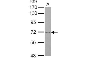 Western Blotting (WB) image for anti-Solute Carrier Family 4, Sodium Bicarbonate Cotransporter, Member 8 (SLC4A8) (N-Term) antibody (ABIN1494094)