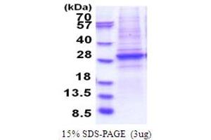 SDS-PAGE (SDS) image for SWI/SNF Related, Matrix Associated, Actin Dependent Regulator of Chromatin, Subfamily A, Member 4 (SMARCA4) (AA 362-549) protein (His tag) (ABIN5853860)