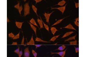 Immunofluorescence analysis of L929 cells using GLB1 Polyclonal Antibody at dilution of 1:100. (GLB1 antibody)