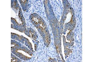 IHC analysis of FH using anti-FH antibody . (FH antibody)