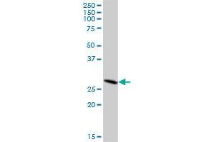 DHRS4L2 MaxPab polyclonal antibody. (DHRS4L2 antibody  (AA 1-230))
