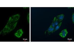 ICC/IF Image PCK2 antibody [C1C2], Internal detects PCK2 protein at mitochondria by immunofluorescent analysis. (PEPCK antibody)