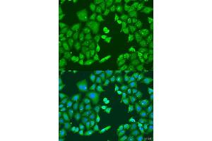 Immunofluorescence analysis of U2OS cells using CYP11B1 antibody (ABIN6292452) at dilution of 1:100.