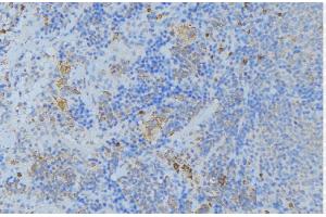 ABIN6277009 at 1/100 staining Human lymph node tissue by IHC-P. (Periostin antibody  (N-Term))