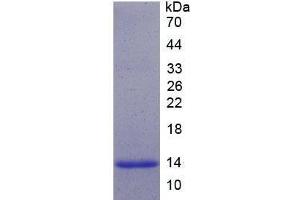 SDS-PAGE analysis of Human Neurogenin 3 Protein. (Neurogenin 3 Protein (NEUROG3))