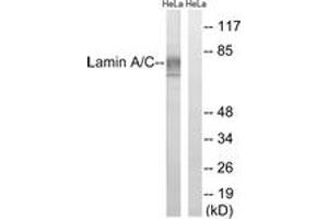 Western blot analysis of extracts from HeLa cells, treated with paclitaxel 1uM 24h, using Lamin A (Ab-22) Antibody.