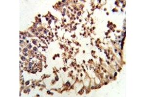 IHC analysis of FFPE human testis tissue stained with Retinoblastoma antibody (Retinoblastoma Protein (Rb) antibody  (AA 858-886))