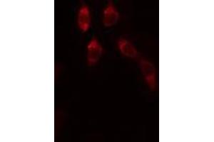 ABIN6272464 staining Hela by IF/ICC. (WDHD1 antibody  (Internal Region))