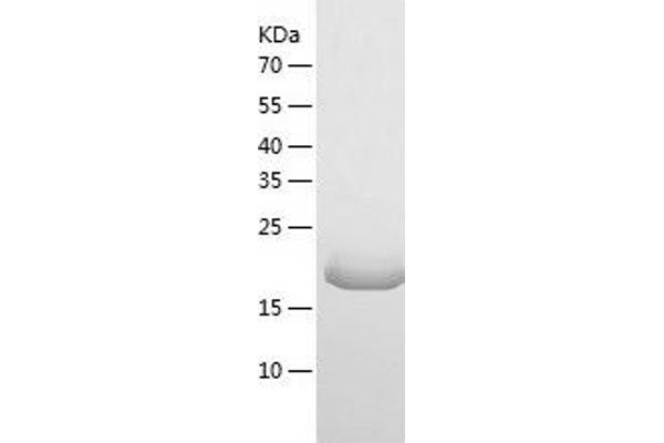 IL36A/IL1F6 Protein (AA 1-160) (His tag)