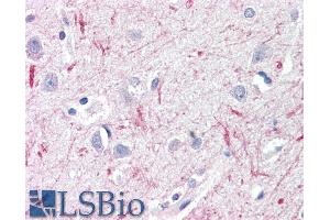 ABIN571068 (10µg/ml) staining of paraffin embedded Human Cortex. (Deltex Homolog 3 antibody  (Internal Region))