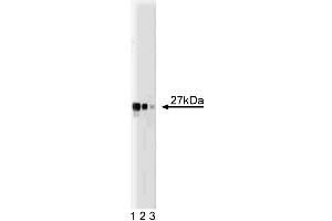 Western blot analysis of Drp1 on a HCT-8 cell lysate (Human colorectal adenocarcinoma, ATCC CCL-244). (Density Regulated Protein antibody  (AA 19-201))