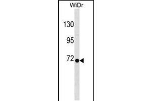 Western blot analysis in WiDr cell line lysates (35ug/lane). (RPN1 antibody  (C-Term))