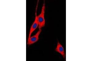 Immunofluorescent analysis of BEGAIN staining in Hela cells. (BEGAIN antibody  (C-Term))
