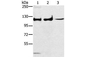Western Blot analysis of Human fetal muscle tissue, A172 and K562 cell using ERK 5 Polyclonal Antibody at dilution of 1:250 (MAPK7 antibody)