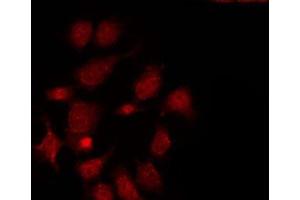 ABIN6275490 staining LOVO by IF/ICC. (ARHGAP17 antibody  (Internal Region))