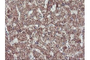 Immunohistochemical staining of paraffin-embedded Human liver tissue using anti-PECI mouse monoclonal antibody. (PECI/ECI2 antibody)