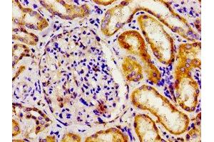 APOBEC3D antibody  (AA 250-371)