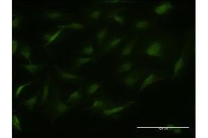 Immunofluorescence of monoclonal antibody to RALGPS2 on HeLa cell. (RALGPS2 antibody  (AA 282-386))