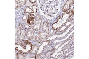 Immunohistochemical staining of human kidney with PRR13 polyclonal antibody  shows strong cytoplasmic positivity in renal tubules. (Proline Rich 13 antibody)