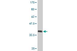 Western Blot detection against Immunogen (35. (ZNF101 antibody  (AA 112-201))