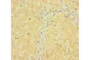 Immunohistochemistry of paraffin-embedded human liver tissue using ABIN7173003 at dilution of 1:100