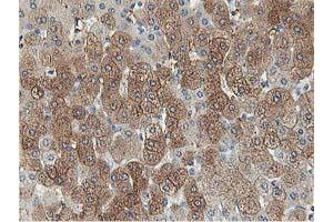 Image no. 3 for anti-Aldolase B, Fructose-Bisphosphate (ALDOB) antibody (ABIN1496605) (ALDOB antibody)