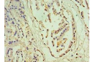 Immunohistochemistry of paraffin-embedded human prostate tissue using ABIN7155843 at dilution of 1:100 (OTX2 antibody  (AA 140-280))