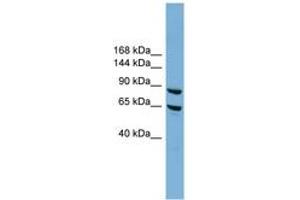 Image no. 1 for anti-Exocyst Complex Component 6 (EXOC6) (N-Term) antibody (ABIN6744168)