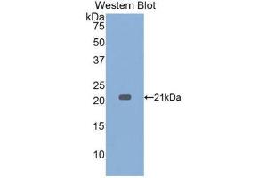 WB of Protein Standard: different control antibodies against Highly purified E. (TNF alpha ELISA Kit)
