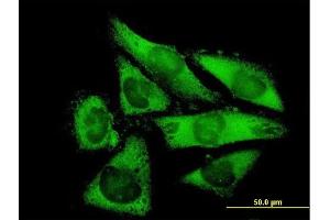 Immunofluorescence of purified MaxPab antibody to NACAL on HepG2 cell. (NACA2 antibody  (AA 1-215))