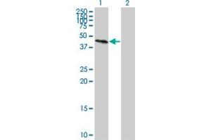Western Blot analysis of GALT expression in transfected 293T cell line by GALT monoclonal antibody (M01), clone 4C11. (GALT antibody  (AA 1-379))