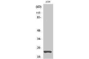 Western Blotting (WB) image for anti-MAD2 (Internal Region) antibody (ABIN3175895) (MAD2 antibody  (Internal Region))