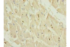 Immunohistochemistry of paraffin-embedded human heart tissue using ABIN7163997 at dilution of 1:100