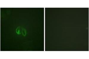 Immunofluorescence analysis of HepG2 cells, using IL-10R alpha (Ab-496) Antibody.