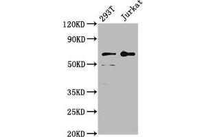 Western Blot Positive WB detected in: 293T whole cell lysate, Jurkat whole cell lysate All lanes: LILRB2 antibody at 4 μg/mL Secondary Goat polyclonal to rabbit IgG at 1/50000 dilution Predicted band size: 66, 65, 56, 52 kDa Observed band size: 66 kDa (LILRB2 antibody  (AA 406-563))