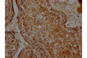 IHC image of ABIN7127862 diluted at 1:100 and staining in paraffin-embedded human placenta tissue performed on a Leica BondTM system. (Recombinant TNFRSF12A antibody)