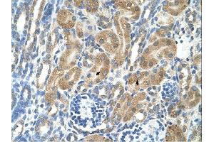 PARL antibody was used for immunohistochemistry at a concentration of 4-8 ug/ml. (PARL antibody  (N-Term))
