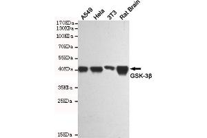 GSK3 beta antibody