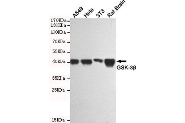 GSK3 beta Antikörper