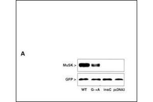 MuSK protein expression in extracts of COS cells after transfection with MuSK mutated and GFP constructs.