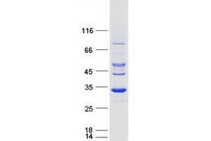Western Blotting (WB) image for Short Chain Dehydrogenase/reductase Family 9C, Member 7 (SDR9C7) protein (Myc-DYKDDDDK Tag) (ABIN2731540)