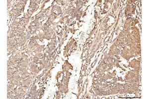 IHC analysis of BHMT using anti-BHMT antibody (ABIN7599940). (BHMT antibody  (AA 13-386))