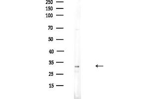 Western blot analysis of lysates from HUVEC cells(UV,30 min treatment), using SUL Antibody at 1/1000 dilution. (SULT4A1 antibody  (C-Term))
