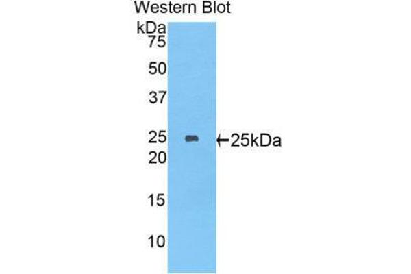 MYH8 antibody  (AA 40-240)